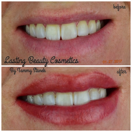 Permanent lips Madison by Lasting Beauty Cosmetics